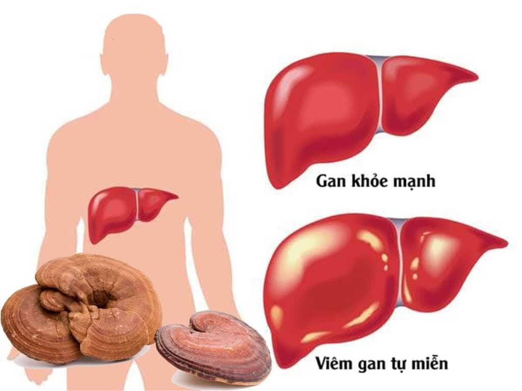 Gan khỏe mạnh với nấm linh chi