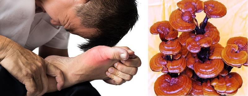 tác dụng nấm linh chi với bệnh gout