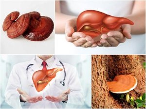 Nấm lim xanh giúp giải độc cho gan hiệu quả