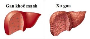 Nấm lim xanh có tác dụng điều trị bệnh gan