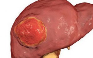 Nấm lim xanh hỗ trợ điều trị nhiều chứng bệnh về gan