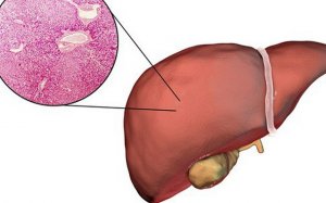 Có rất nhiều nguyên nhân khiến lá gan hoạt động kém hiệu quả