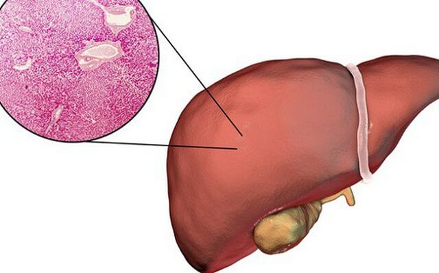 Nấm linh xanh điều trị bệnh về gan