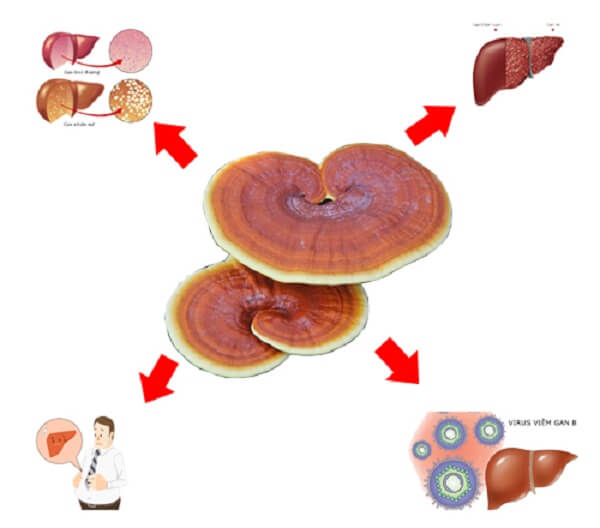Tác dụng của nấm lim xanh với bệnh gan nhiễm mỡ