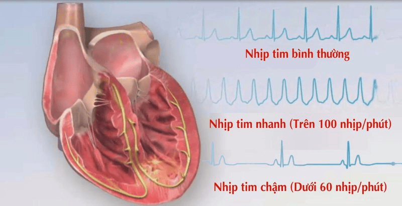 Tác dụng của adenosine