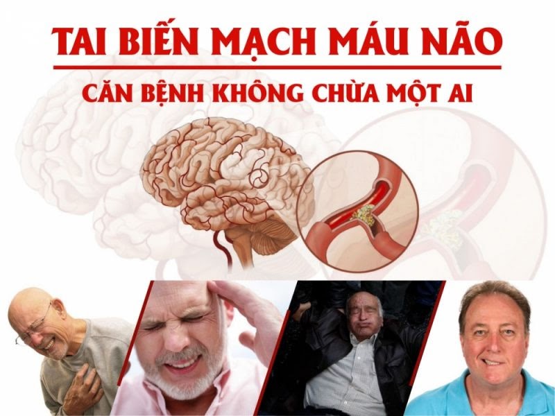 Bệnh tại biến mạch máu não có nên dùng đông trùng hạ thảo