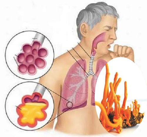Đông trùng hạ thảo có bổ phổi không