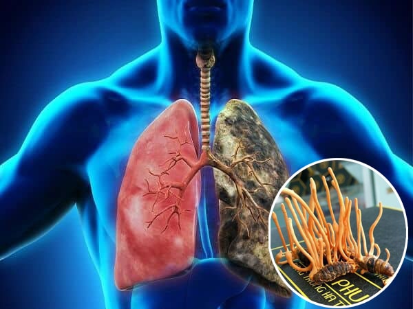 tác dụng đông trùng hạ thảo với bệnh ung thư phổi