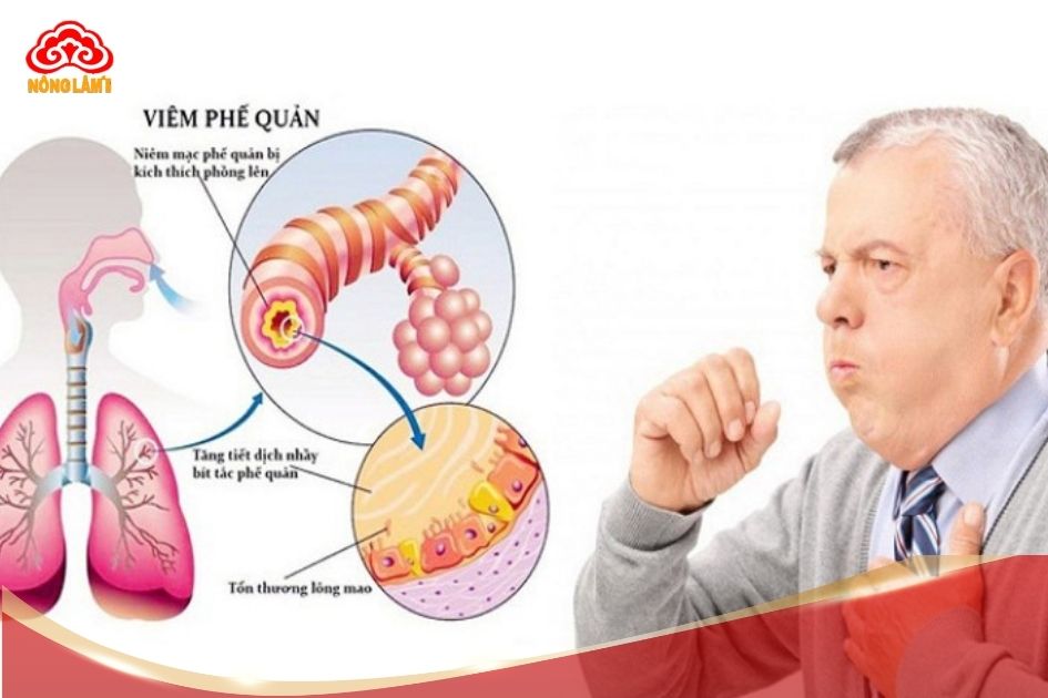 Nấm linh chi hỗ trợ giảm viêm và cải thiện tình trạng đường hô hấp