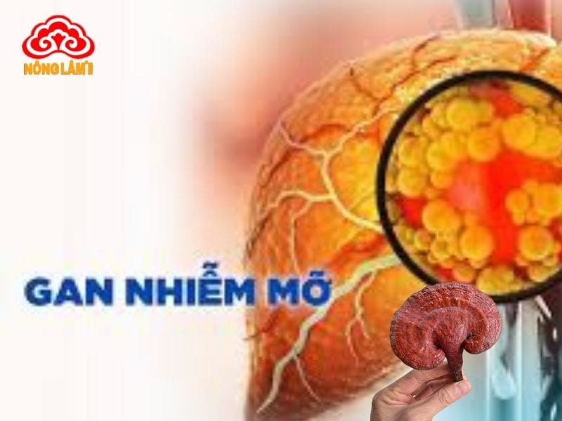 Tác Dụng Của Nấm Lim Xanh Với Bệnh Gan Nhiễm Mỡ 11 Lưu ý khi dùng nấm lim xanh cho bệnh nhân gan nhiễm mỡ