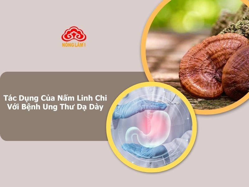 nấm linh chi hỗ trợ điều trị bệnh ung thư dạ dày