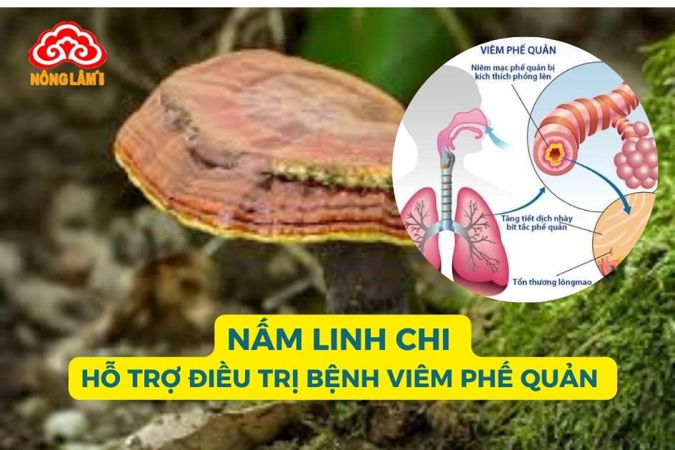 Nấm linh chi hỗ trợ điều trị bệnh viêm phế quản hiệu quả