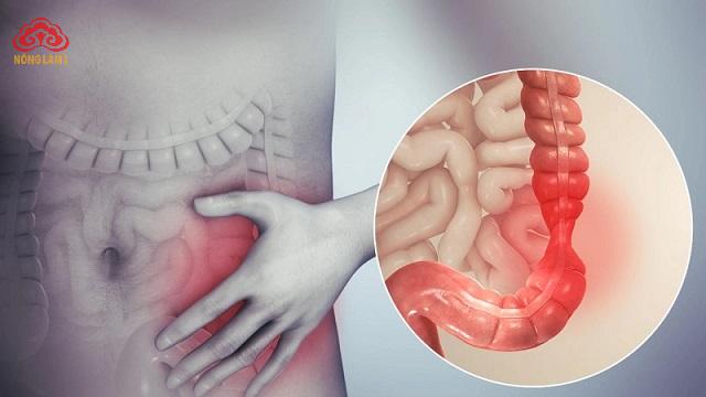 Nấm Linh Chi và Bệnh Đại Tràng Co Thắt (IBS): Sự Thật & Hiệu Quả 5 bệnh đại tràng co thắt