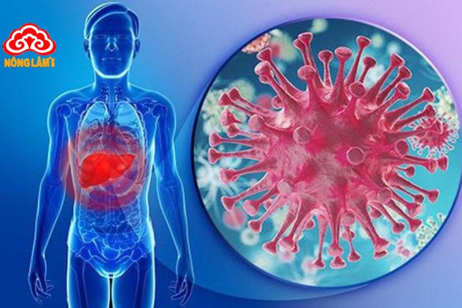 Viêm gan B là một bệnh truyền nhiễm nguy hiểm, và nguyên nhân chính gây ra bệnh là do virus viêm gan B (HBV