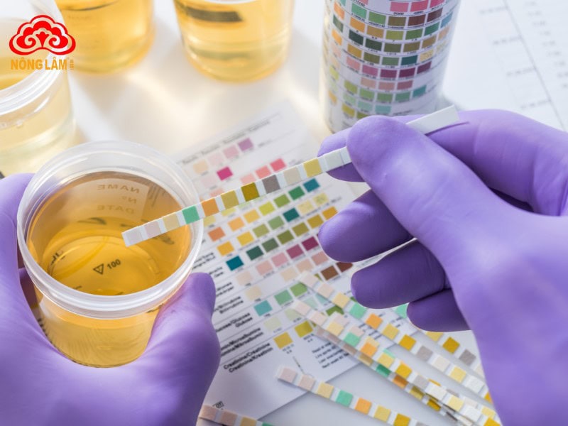 Lạm Dụng Đông Trùng Hạ Thảo Có Thể Gây Suy Thận? 9 Dấu hiệu cảnh báo dùng đông trùng hạ thảo sai cách