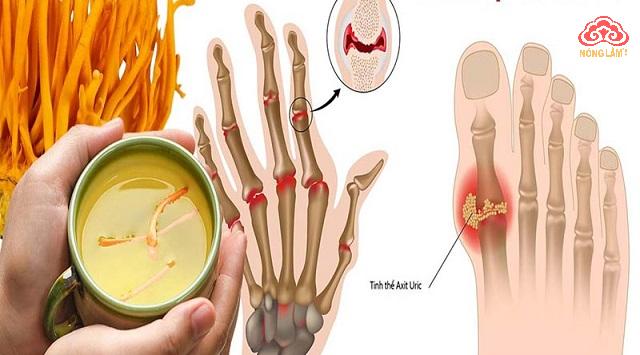 Có Nên Dùng Đông Trùng Hạ Thảo Điều Trị Bệnh Gout? 2