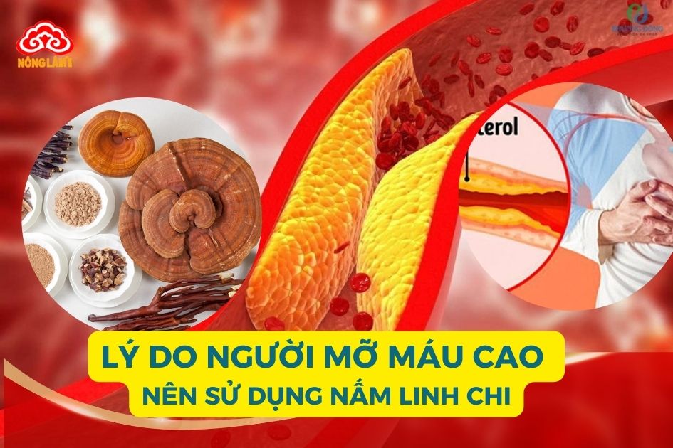 Lý do người mỡ máu cao nên dùng nấm linh chi