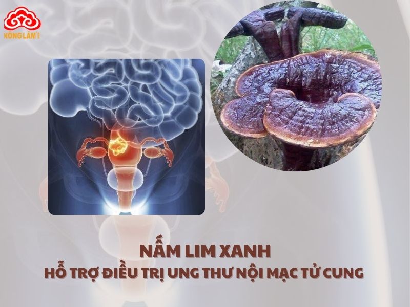 Nấm linh xanh là một liệu pháp hỗ trợ tiềm năng trong việc điều trị ung thư nội mạc tử cung