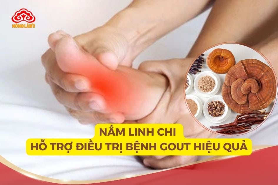 Nấm linh chi hỗ trợ điều trị bệnh gout hiệu quả