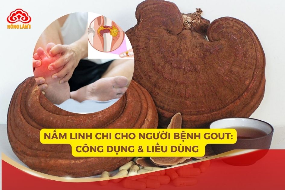 Nấm Linh Chi Cho Người Bệnh Gout: Công Dụng & Liều Dùng?