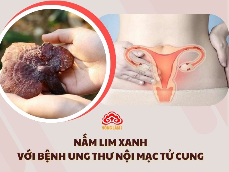 Lợi Ích Của Nấm Lim Xanh Với Bệnh Ung Thư Nội Mạc Tử Cung