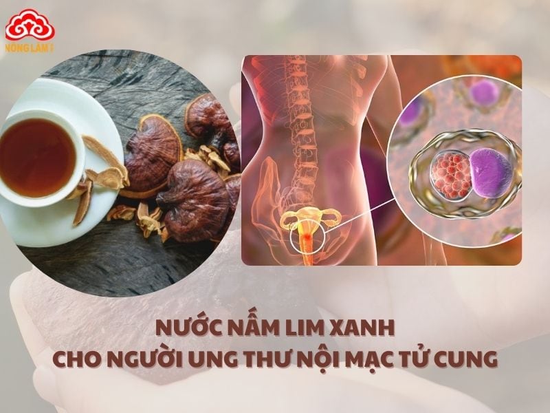 Nấu nước nấm lim xanh là cách phổ biến nhất vì dễ thực hiện, giữ được các dưỡng chất trong nấm