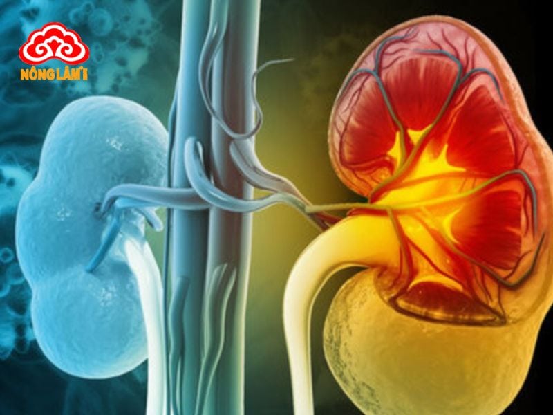 Lạm Dụng Đông Trùng Hạ Thảo Có Thể Gây Suy Thận? 7 Sử dụng đông trùng hạ thảo sai cách có thể gây suy thận