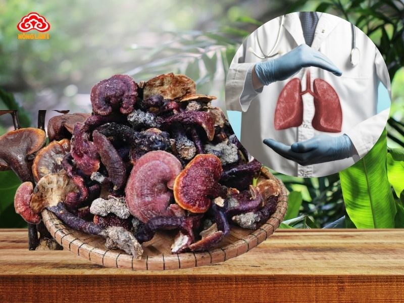 Nấm lim xanh mang lại nhiều lợi ích của bệnh ung thư phổi