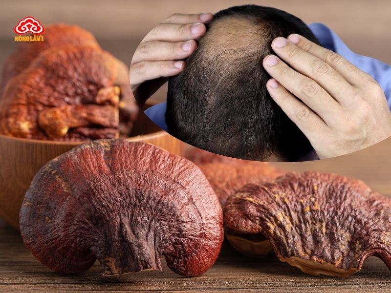 Nấm linh chi ngăn ngừa rụng tóc hói đầu