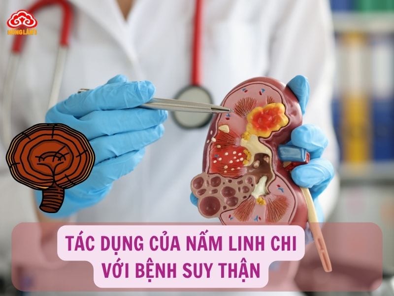 Tác dụng của nấm linh chi với bệnh suy thận