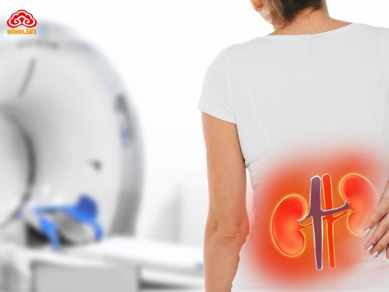 Bệnh suy thận là tình trạng chức năng của thận bị suy giảm nghiêm trọng