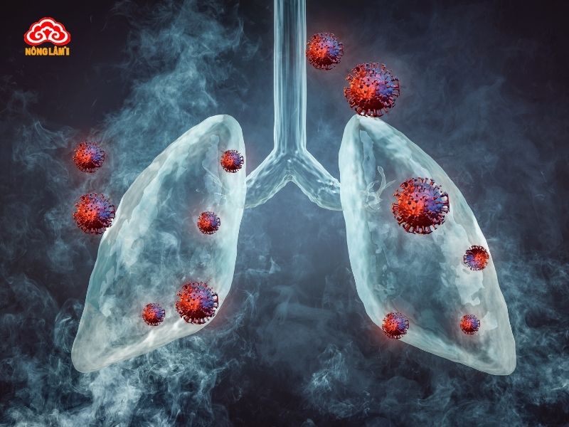 Tìm hiểu về ung thư phổi