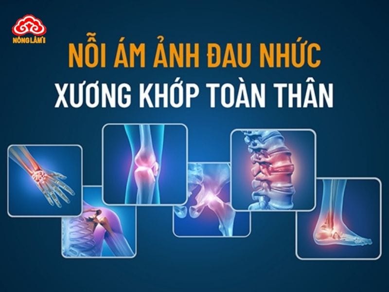 Bệnh đau nhức xương khớp