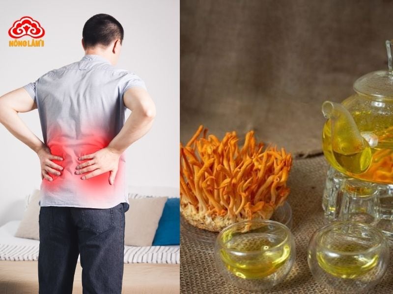Trà đông trùng hạ thảo hỗ trợ điều trị bệnh sỏi thận