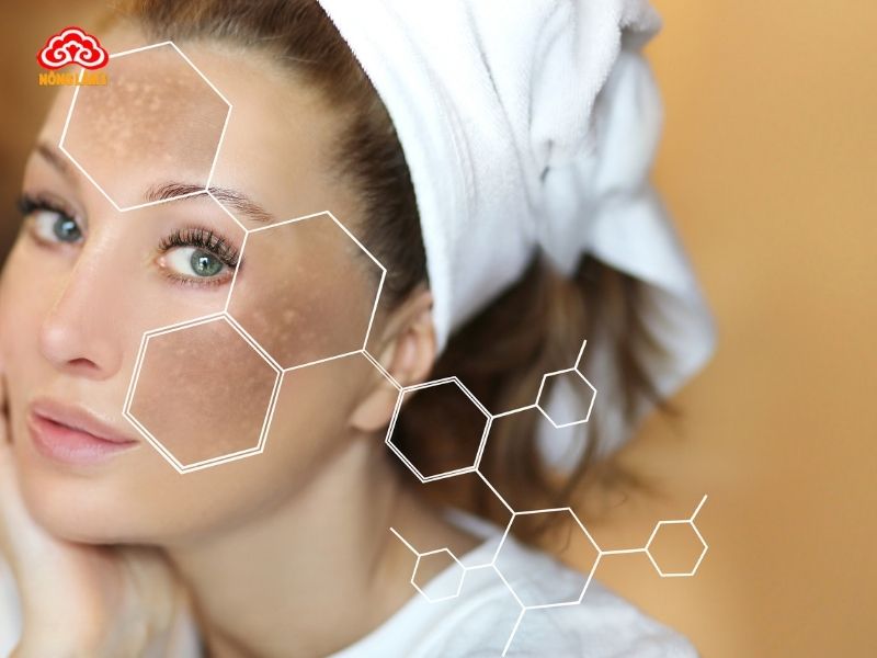 Hiểu rõ hơn về nám da