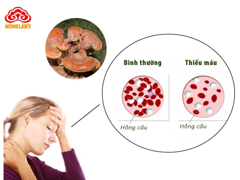 Nấm Lim Xanh - Thảo Dược Tốt Cho Người Thiếu Máu 9 Nấm lim xanh tốt cho người thiếu máu