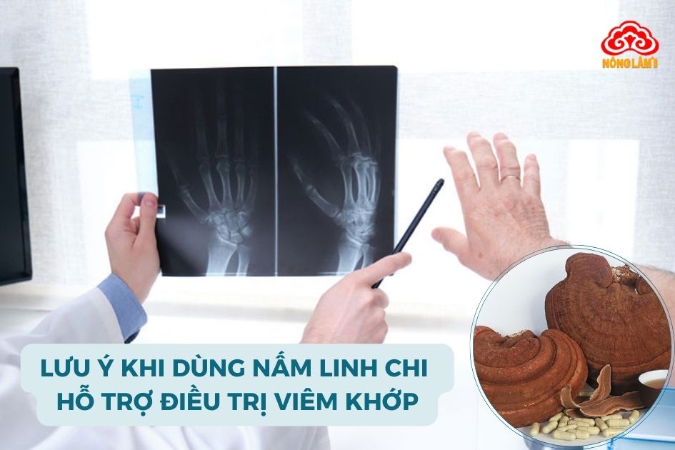 Lưu ý quan trọng khi dùng nấm linh chi hỗ trợ điều trị viêm khớp