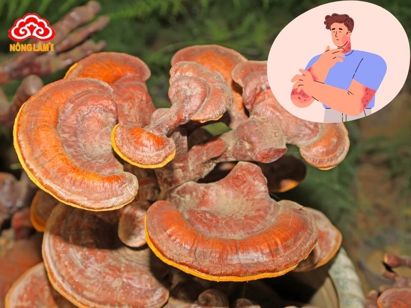 Nấm linh chi tác động trực tiếp vào căn nguyên gây bệnh viêm da dị ứng