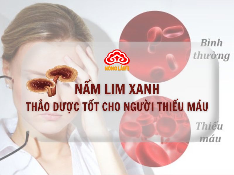 Nấm Lim Xanh - Thảo Dược Tốt Cho Người Thiếu Máu 7 Nấm lim xanh tốt cho người thiếu máu