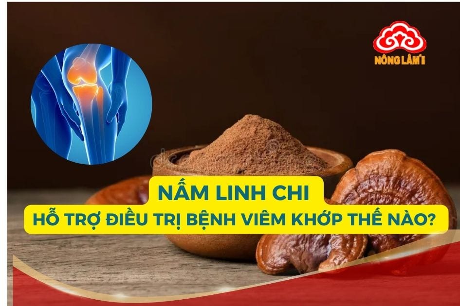 Nấm linh chi có nhiều lợi ích đối với bệnh nhân viêm khớp