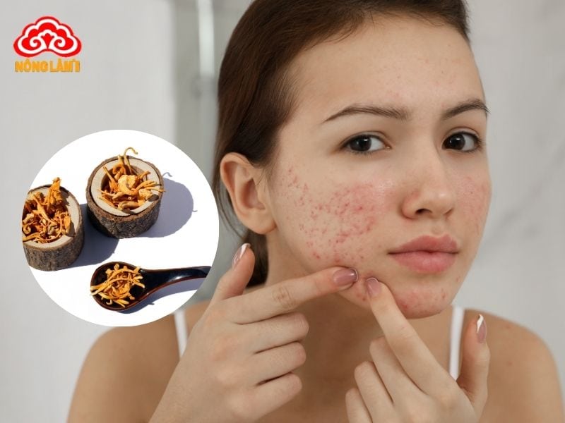 Tác dụng của đông trùng hạ thảo với tuổi dậy thì