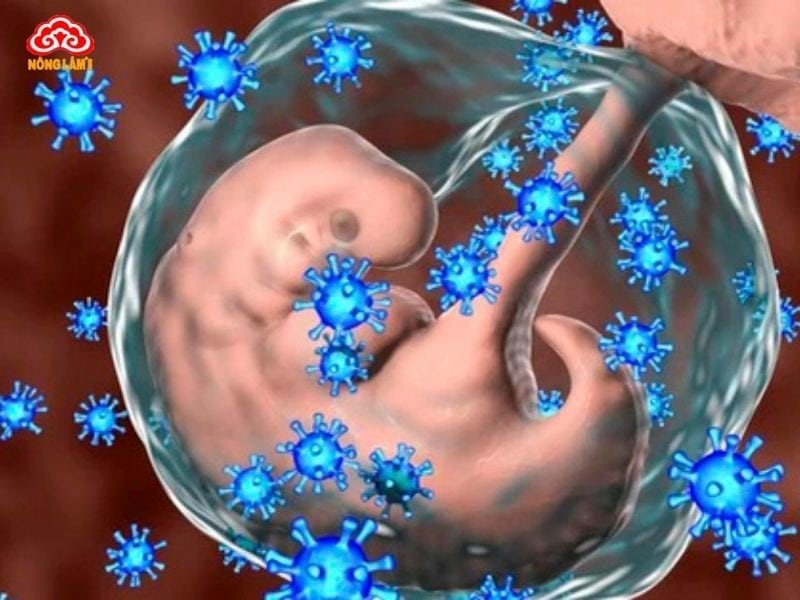 Viêm Gan B: Nguyên Nhân, Triệu Chứng, Điều Trị Và Cách Phòng Ngừa 12 Con đường lây nhiễm viêm gan b