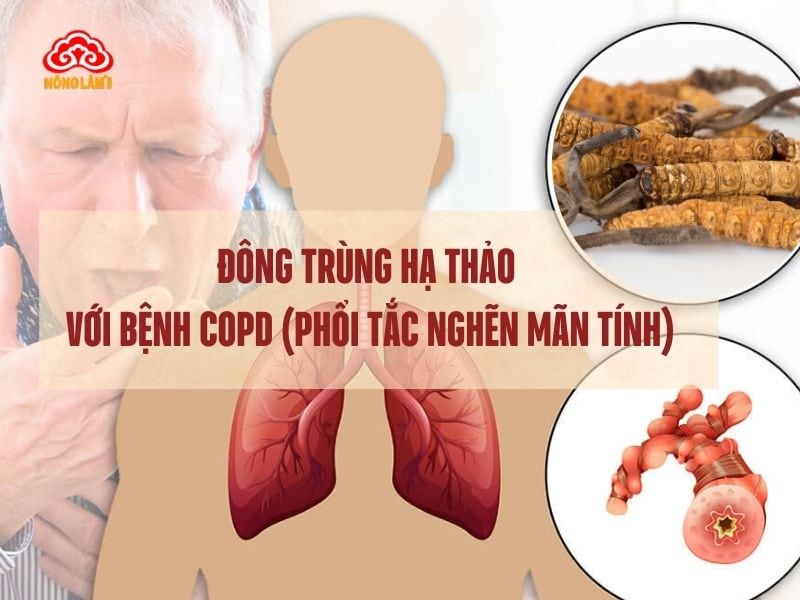 Đông Trùng Hạ Thảo Với Bệnh Copd (Phổi Tắc Nghẽn Mạn Tính) 7 Đông trùng hạ thảo với bệnh copd