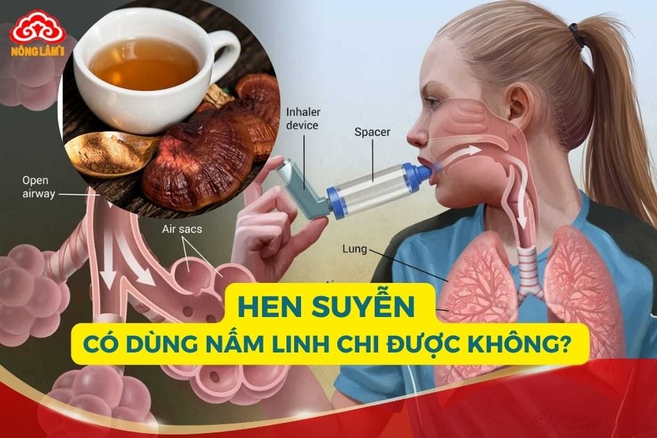 Hen suyễn có dùng được nấm linh chi không?