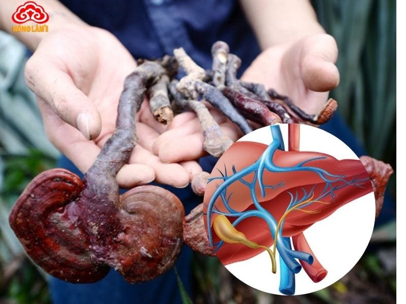 Nấm Lim Xanh Hỗ Trợ Điều Trị Các Bệnh Thường Gặp Ở Gan 10 Lưu ý khi dùng nấm lim xanh chữa bệnh gan