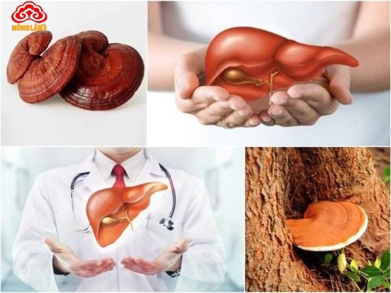 Nấm Lim Xanh Hỗ Trợ Điều Trị Các Bệnh Thường Gặp Ở Gan 7 Nấm lim xanh hỗ trợ nhiều bệnh ở gan