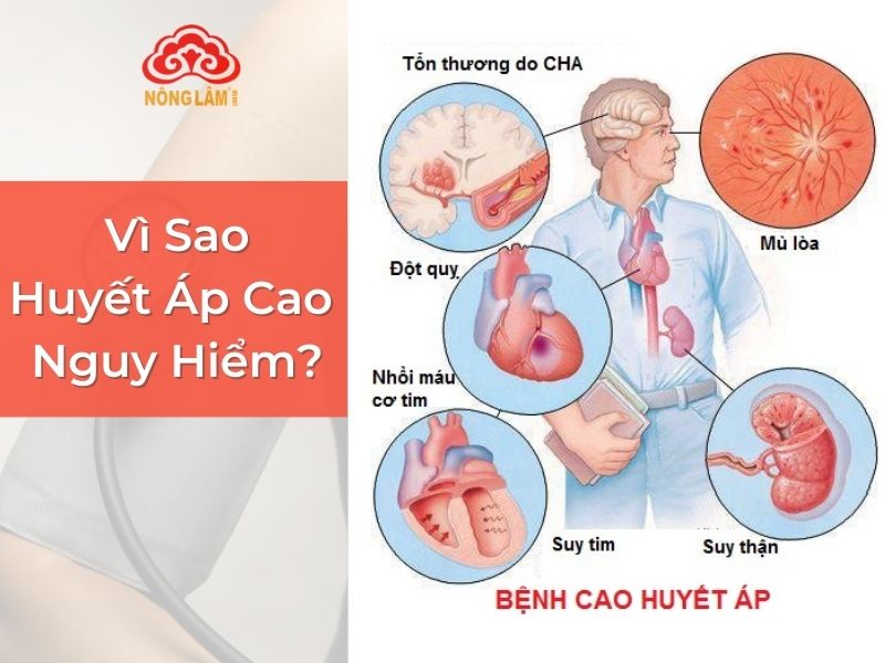 Người cao huyết áp nên dùng thảo dược gì