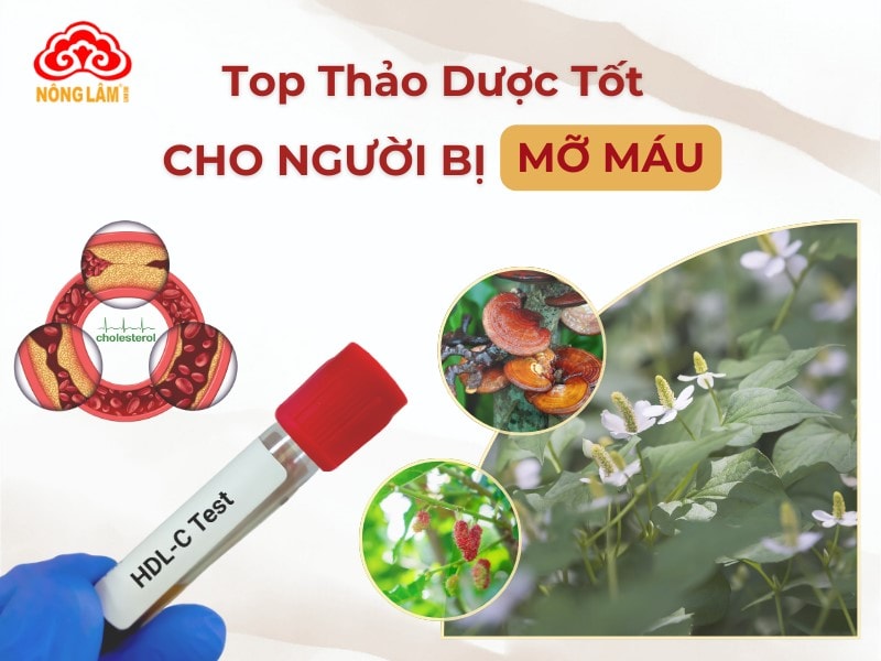 Những thảo dược tốt cho người bệnh mỡ máu cao