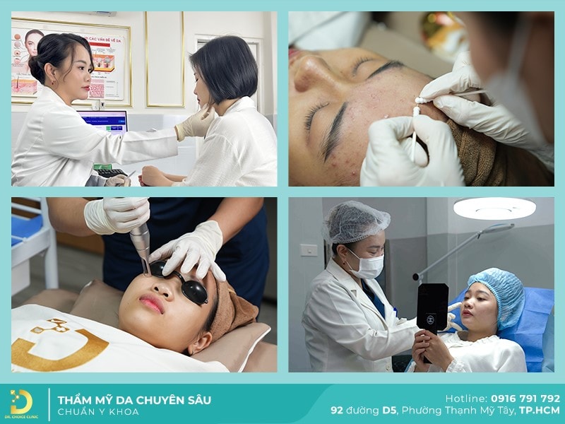 6 Phòng Khám Da Liễu Tphcm Uy Tín, An Toàn, Hiệu Quả 14 Dr. Choice clinic – phòng khám da liễu chuẩn y khoa