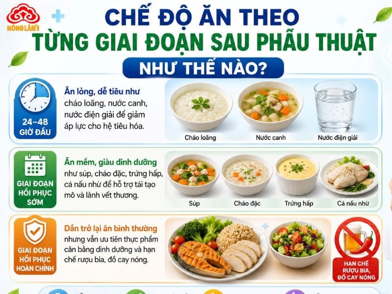 Sau Phẫu Thuật Nên Ăn Gì, Kiêng Ăn Gì Để Nhanh Lành? 12 Chế độ ăn từng giai đoạn sau phẫu thuật